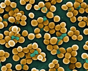 Staphylococcus aureus im Rasterelektronenmikroskop (koloriert)
