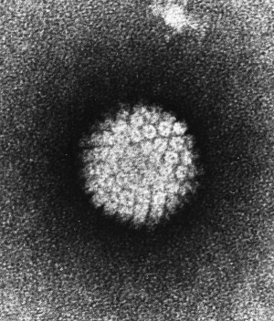 Elektronenmikroskopische Aufnahme eines menschlichen Papillomavirus (HPV)
