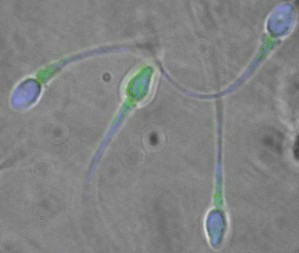 Eine Farbmarkierung (grüne Punkte) macht Unterschiede in der Zusammensetzung der Spermienhüllen sichtbar.