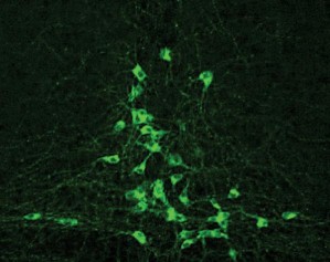 Serotonin-produzierende Neuronen (nach Fluoreszenzfärbung)