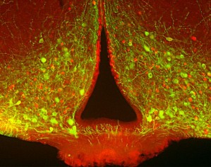 Das Gefühl von Sättigung erzeugende Neuronen (grün) im Hypothalamus, von denen einige (mit rotem Kern) aktiviert wurden