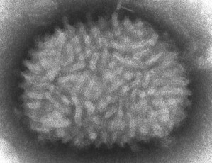 Vaccinia-Virus im Elektronenmikroskop
