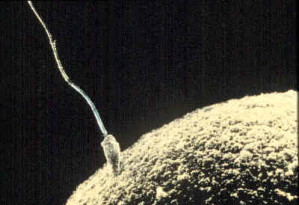 Kontakt zwischen Spermium und Eizelle (elektronenmikroskopische Aufnahme)