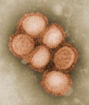 Schweinegrippeviren im Elektronenmikroskop (koloriert)