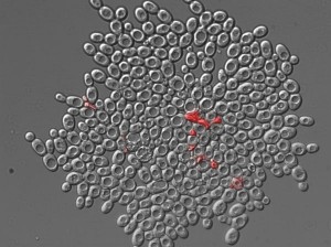 Flockenförmiger Zellverband von Hefen mit toten Zellen (rot gefärbt)