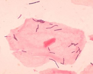 Typische Milchsäurebakterien der Gattung Lactobacillus (blau gefärbte Stäbchen) in einem Vaginalabstrich