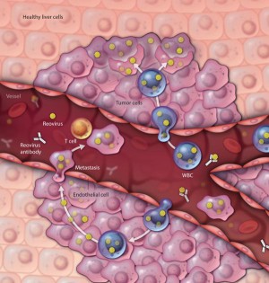 Reoviren (gelb) gelangen zusammen mit weißen Blutkörperchen aus einem Blutgefäß in das Tumorgewebe und infizieren dort die Krebszellen.