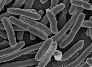 Escherichia coli (rasterelektronenmikroskopische Aufnahme) ist die bekannteste von mehreren hundert Arten von Darmbakterien.