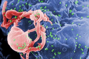 AIDS-Viren vom Typ HIV-1 (grün) werden aus einem infizierten Lymphozyten freigesetzt (rasterelektronenmikroskopische Aufnahme).