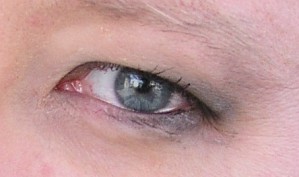 Manche degenerativen Erkrankungen schädigen die Netzhaut im Auge derart, dass es zur Erblindung kommt.