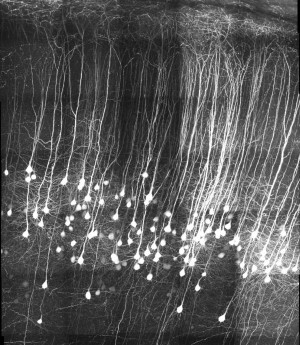 3-D-Rekonstruktion von Neuronen im somatosensorischen Cortex