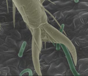 Gekrümmte Trichome (grün) auf der Oberfläche von Bohnenblättern durchbohren den Fuß (gelb) einer Bettwanze.
