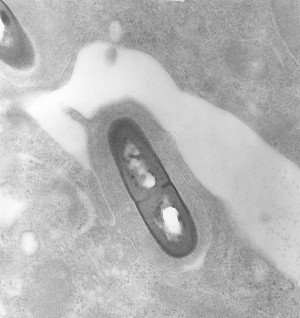 Listeria monocytogenes kann durch kontaminierte Lebensmittel auf Menschen übertragen werden und Infektionen verursachen (elektronenmikroskopische Aufnahme).