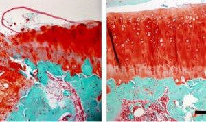 Eine Behandlung mit Antikörpern gegen den Wachstumsfaktor TGF-beta1 (rechtes Bild) verhindert Arthroseschäden im Kniegelenk von Ratten (linkes Bild: ohne Behandlung, Knochen = grün, Knorpel = rot).