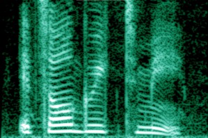 Spektrogramm (Analyse der Schallsignale) einer menschlichen Stimme