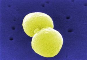Pneumokokken (Streptococcus pneumoniae) bilden paarweise gelagerte Einzelzellen (gefärbte rasterelektronenmikroskopische Aufnahme).