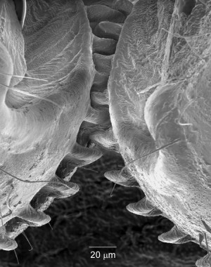 Elektronenmikroskopische Aufnahme der Zahnräder an den Hinterbeinen der Echten Käferzikade
