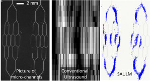 Ultraschallaufnahme: Mikrokanäle (links) können mit reflektierenden Mikroblasen (rechts) genauer sichtbar gemacht werden als mit herkömmlichen Ultraschallsonden (Mitte).
