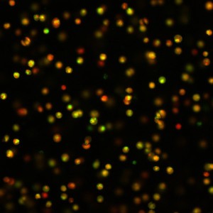 Fluoreszenzfarbstoffe zeigen an, ob Kalziumkonzentrationen in Knorpelzellen steigen (grün) oder sinken (rot).