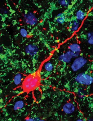 Nervenfortsätze (grün) verbinden den Thalamus mit Neuronen (rot) im Hörzentrum der Großhirnrinde (Zellkerne = blau).