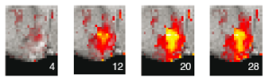  Erste MRI-Aufnahmen der zeitlich veränderlichen Dopaminkonzentration im Rattenhirn