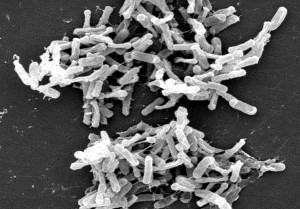 Clostridien sind anaerobe, sporenbildende Stäbchenbakterien, die in der Umwelt verbreitet und Teil der normalen Darmflora sind. (Rasterelektronenmikroskopische Aufnahme von Clostridium difficile aus einer Stuhlprobe)