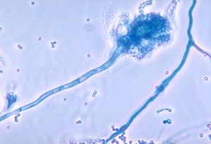 Hyphen und Sporen von Aspergillus fumigatus