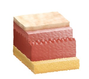 Querschnitt durch die Haut: Oberhaut (zweischichtig dargestellt), Lederhaut (dunkelrot) und Unterhaut (mit Fettgewebe, gelb)