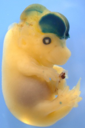 Ein gentechnisches Verfahren macht die Aktivität des menschlichen Genschalters HARE5 während der Hirnentwicklung eines Mäuseembryos durch Blaufärbung sichtbar.