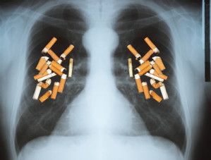 Rauchen - auch wenn es nur wenige Zigaretten am Tag sind - erhöht das Risiko für Lungenkrebs. 