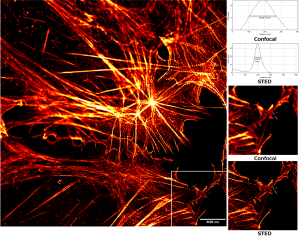 Hochaufgelöste STED-Mikroskopaufnahme zeigt Aktin-Fasern im Zytoskelett einer Zelle.