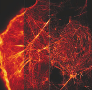 Cytoskelett einer lebenden Zelle unter einem Fluoreszenz-Mikroskop (SIM)