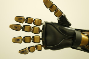 Prothese mit druckempfindlicher Sensorhaut auf den Fingerspitzen