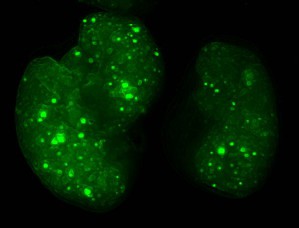 Exosome von Tumoren (leuchtend grün) verschmelzen mit Lungenzellen von Mäusen (digital bearbeitet).