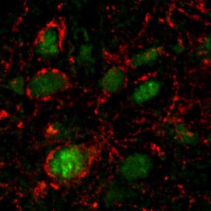 E. coli-Proteine aktivieren appetithemmende Neuronen (grün) im Hypothalamus von Ratten.