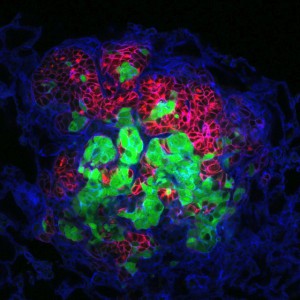 Die Metastase eines Brustkrebstumors im Lungengewebe (blau) besteht aus einem Gemisch von rot und grün fluoreszierenden Typen von Krebszellen.