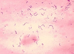 Eine bestimmte Variante des Karieserregers Streptococcus mutans kann Hirnblutungen auslösen und so einen Schlaganfall verursachen.