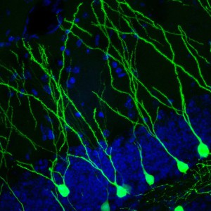 Freiwilliges Laufradtraining fördert die Bildung neuer Nervenzellen (durch grüne Fluoreszenzmarkierung sichtbar gemacht) im Hippocampus von erwachsenen Mäusen.