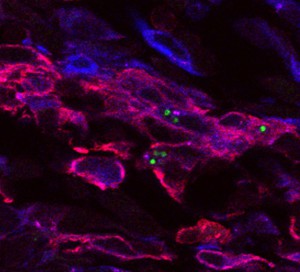 Leishmanien (grün) vermehren sich im Inneren von Immunzellen (pink und blau).