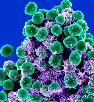 Rasterelektronenmikroskopische Aufnahme von Staphylococcus epidermidis (grün gefärbt)