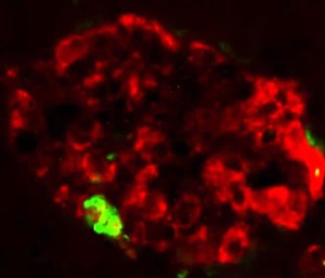 In der Bauchspeicheldrüse des Versuchstieres bilden sich im Bereich der Inselzellen (rot) Ablagerungen (grün) eines fehlgefalteten Proteins.