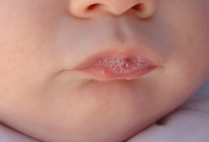 In den ersten Lebensjahren entwickelt sich ein Mund-Mikrobiom, das dem der Eltern und Geschwister gleicht, da Keime über den Speichel ausgetauscht werden.