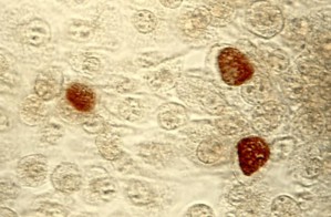 Chlamydien (braun gefärbte Einschlusskörperchen) leben als Parasiten im Innern von Wirtszellen.