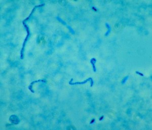 Fusobakterien zählen zur normalen Körperflora von Mundhöhle und Darm (Fusobacterium necrophorum im Phasenkontrastmikroskop).