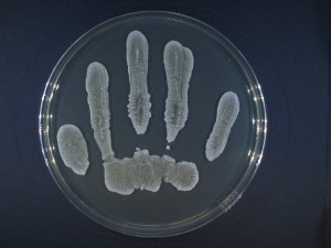Wachstum des Hautkeims Staphylococcus epidermidis auf einer Agarplatte