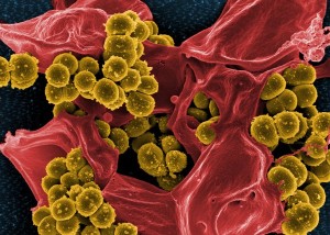 Kugelförmige Staphylococcus aureus-Bakterien vom MRSA-Typ (gelb) werden von einem weißen Blutkörperchen, einem neutrophilen Granulozyten (rot), aufgenommen und zerstört (digital kolorierte rasterelektronenmikroskopische Aufnahme).