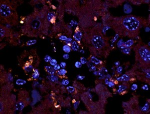 Enterococcus gallinarum-Bakterien (orange Flecke) sind in die Leber einer erkrankten Maus eingewandert (fluoreszenzmikroskopische Aufnahme).