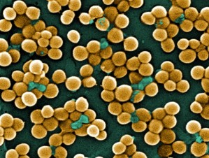 Gegen multiresistente Staphylococcus aureus-Bakterien (MRSA) werden dringend neue Antibiotika gesucht (kolorierte rasterelektronenmikroskopische Aufnahme).