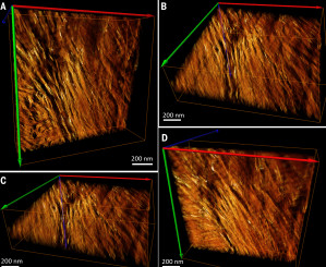 Aufnahmen mit dem Elektronenmikroskop offenbaren die filigranen, faserförmigen Nanostrukturen aus weichem Kollagen und harten Apatit-Kristallen in menschlichen Oberschenkelknochen.