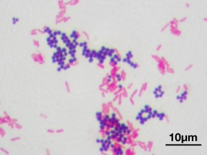Bei der Gramfärbung verhalten sich Staphylokkoken (blau) grampositiv und E. coli (rot) gramnegativ.